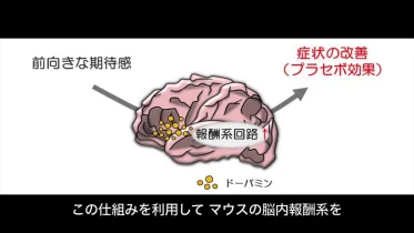 「病は気から」は本当か？ アレルギー界の大きな謎に挑む！